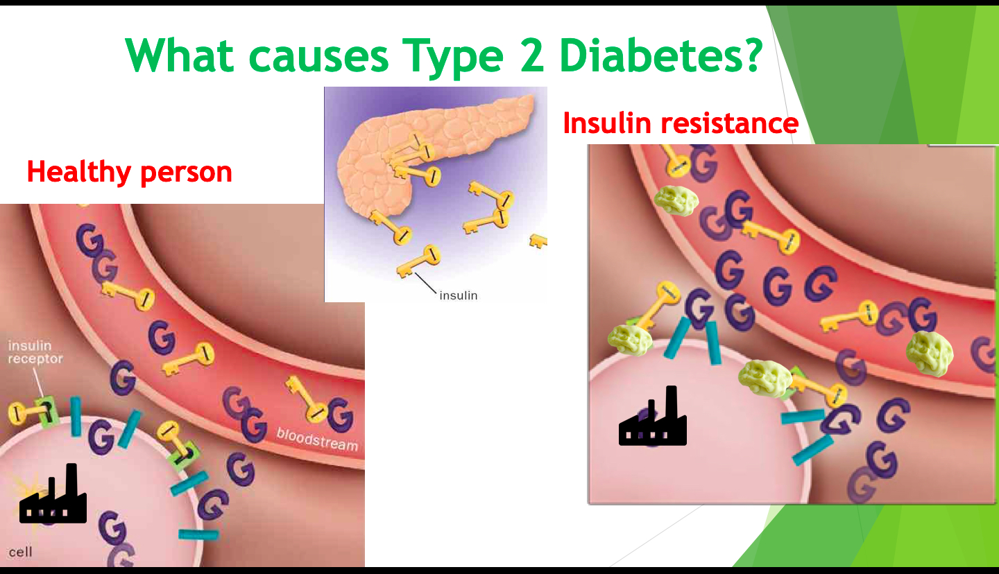 What causes Type 2. Diabetes?
